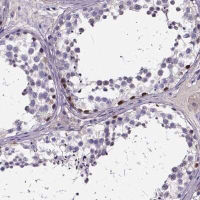 Immunohistochemistry-Paraffin: SPOCD1 Antibody [NBP2-38187]