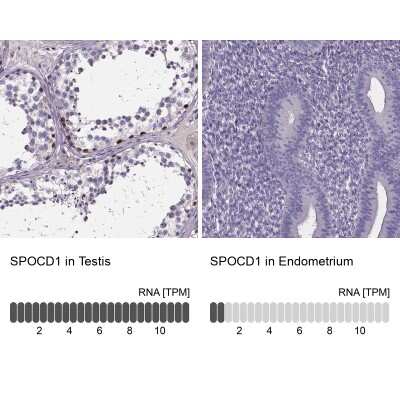 Immunohistochemistry-Paraffin: SPOCD1 Antibody [NBP2-38187]