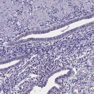 Immunohistochemistry-Paraffin: SPOCD1 Antibody [NBP2-48617]