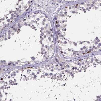 Immunohistochemistry-Paraffin: SPOCD1 Antibody [NBP2-48617]