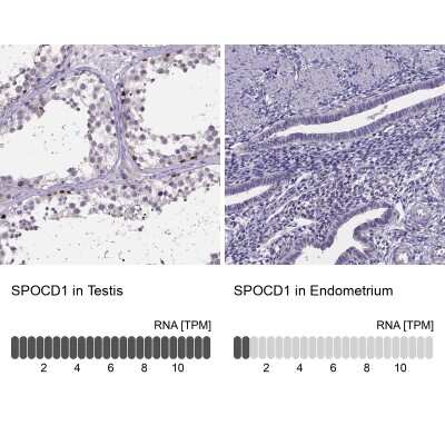 Immunohistochemistry-Paraffin: SPOCD1 Antibody [NBP2-48617]