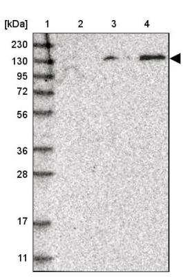 Western Blot: SPOCD1 Antibody [NBP1-93922]