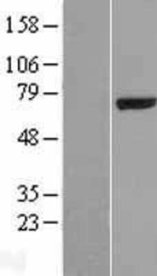 Western Blot: Testican 2/SPOCK2 Overexpression Lysate [NBP2-07266]