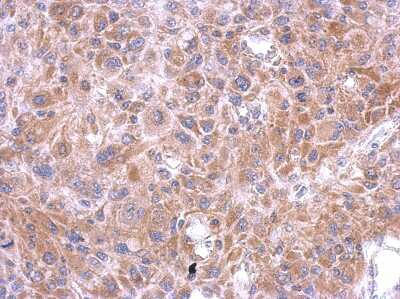 Immunohistochemistry-Paraffin: Testican 3/SPOCK3 Antibody [NBP2-20476]