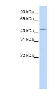 Western Blot: Testican 3/SPOCK3 Antibody [NBP1-59686]