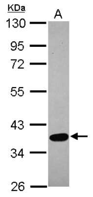 Western Blot: Testican 3/SPOCK3 Antibody [NBP2-20476]