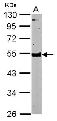 Western Blot: Testican 3/SPOCK3 Antibody [NBP2-20476]