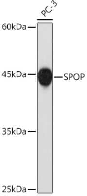 Western Blot: SPOP Antibody (2N8L8) [NBP3-15784]