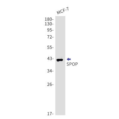 Western Blot: SPOP Antibody (S01-5B7) [NBP3-19781]