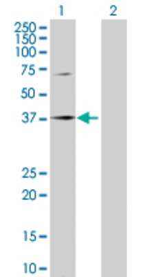 Western Blot: SPOP Antibody [H00008405-D01P]