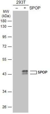 Western Blot: SPOP Antibody [NBP1-33090]