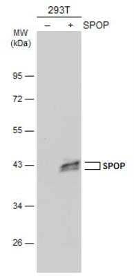 Western Blot: SPOP Antibody [NBP2-20477]