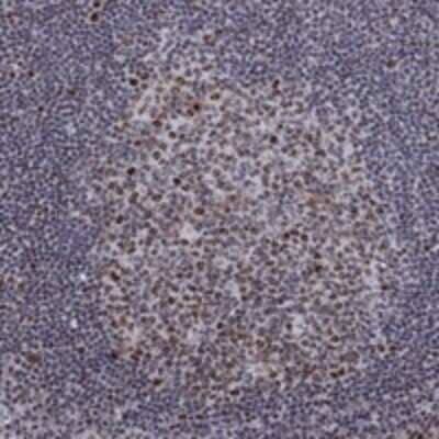 Immunohistochemistry-Paraffin: SPOUT1 Antibody [NBP3-17625]