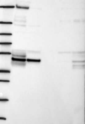 Western Blot: SPOUT1 Antibody [NBP3-17625]