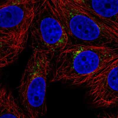 Immunocytochemistry/ Immunofluorescence: SPPL2a Antibody [NBP2-57121]