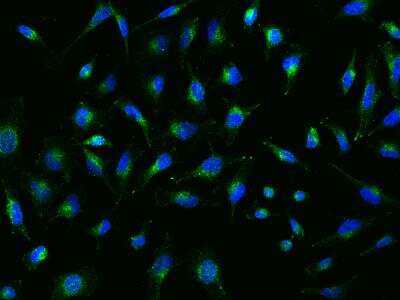 Immunocytochemistry/ Immunofluorescence: SPPL2a Antibody [NBP3-06160]