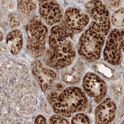 Immunohistochemistry-Paraffin: SPPL2a Antibody [NBP1-87512]