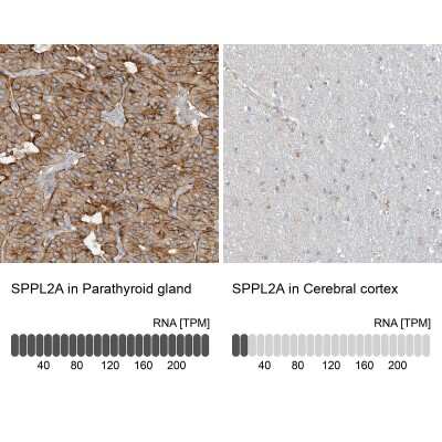 Immunohistochemistry-Paraffin: SPPL2a Antibody [NBP1-87512]