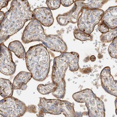 Immunohistochemistry-Paraffin: SPPL2a Antibody [NBP1-87512]