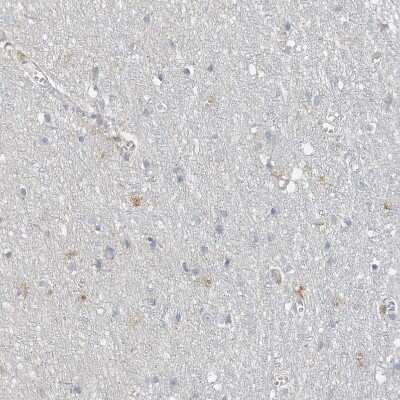 Immunohistochemistry-Paraffin: SPPL2a Antibody [NBP1-87512]