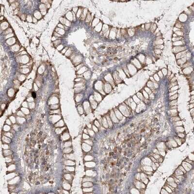 Immunohistochemistry-Paraffin: SPPL2a Antibody [NBP1-87512]
