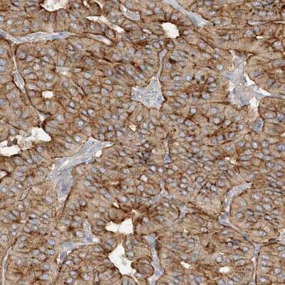 Immunohistochemistry-Paraffin: SPPL2a Antibody [NBP1-87512]