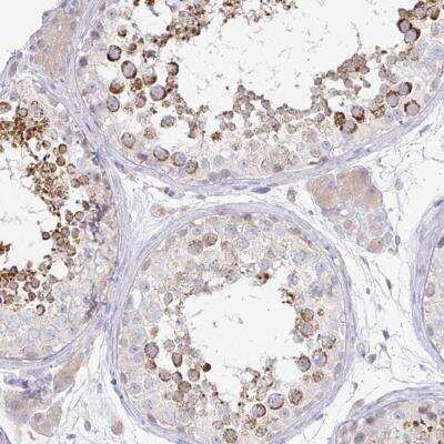 Immunohistochemistry-Paraffin: SPPL3 Antibody [NBP2-32505]