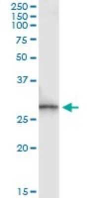 Immunoprecipitation: SPR Antibody (4F2) [H00006697-M01]