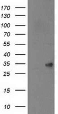Western Blot: SPR Antibody (OTI4F5) [NBP2-03256]
