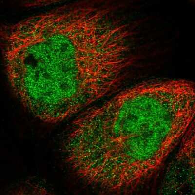 Immunocytochemistry/ Immunofluorescence: SPR Antibody [NBP1-87060]