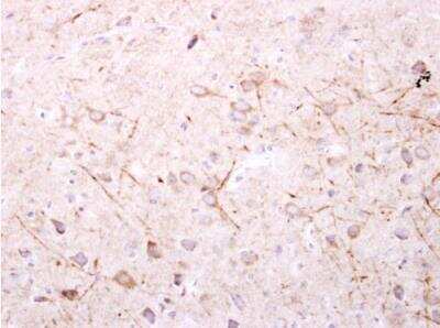 Immunohistochemistry-Paraffin: SPR Antibody [NBP1-33546]