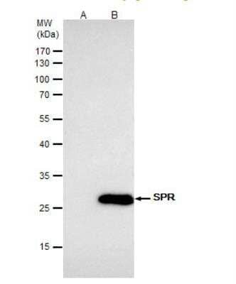 Immunoprecipitation: SPR Antibody [NBP1-33546]