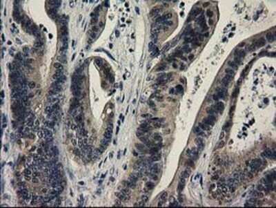 Immunohistochemistry: SPR Antibody (OTI4F5) - Azide and BSA Free [NBP2-74344]