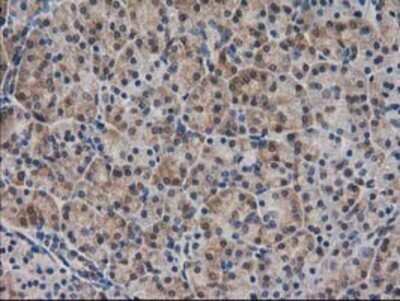 Immunohistochemistry: SPR Antibody (OTI4F5) - Azide and BSA Free [NBP2-74344]