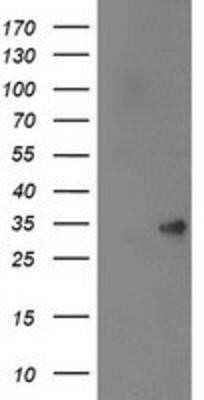 Western Blot: SPR Antibody (OTI4F5)Azide and BSA Free [NBP2-74344]