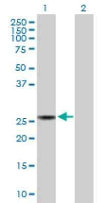 Western Blot: SPR Antibody [H00006697-D01P]