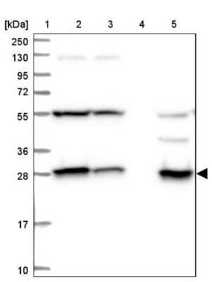 Western Blot: SPR Antibody [NBP1-87060]