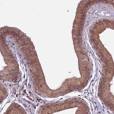 Immunohistochemistry-Paraffin: SPRED1 Antibody [NBP1-89836]