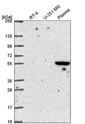 Western Blot: SPRED1 Antibody [NBP2-57368]