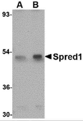 Western Blot: SPRED1 AntibodyBSA Free [NBP2-81926]