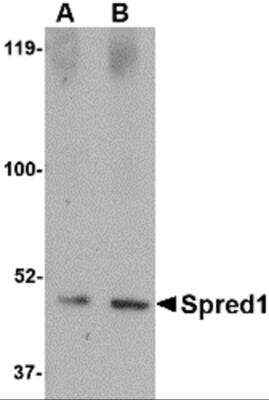 Western Blot: SPRED1 AntibodyBSA Free [NBP2-81927]