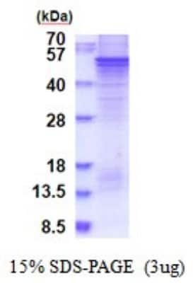 SDS-PAGE: Recombinant Human SPRED1 His Protein [NBP2-51864]