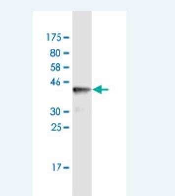 Western Blot: SPRED2 Antibody (2G11) [H00200734-M03]