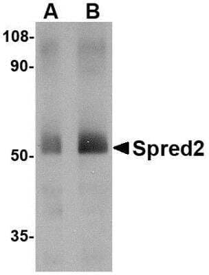 Western Blot: SPRED2 AntibodyBSA Free [NBP1-76342]