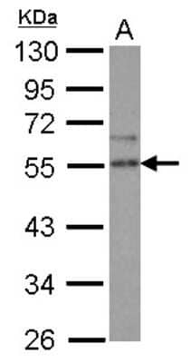 Western Blot: SPRED2 Antibody [NBP2-20478]