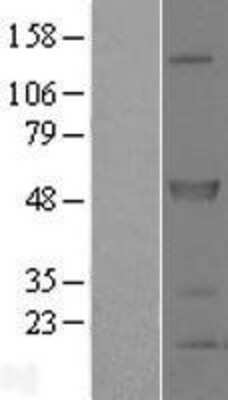 Western Blot: SPRED2 Overexpression Lysate [NBP2-04888]