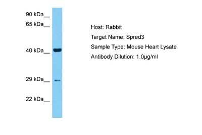 Western Blot: SPRED3 Antibody [NBP2-84280]