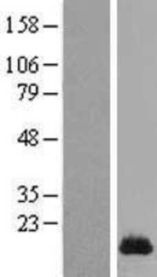 Western Blot: SPRR1A Overexpression Lysate [NBL1-16430]