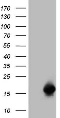 Western Blot: SPRR2A Antibody (OTI4B3) [NBP2-45955]