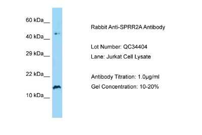 Western Blot: SPRR2A Antibody [NBP2-84281]